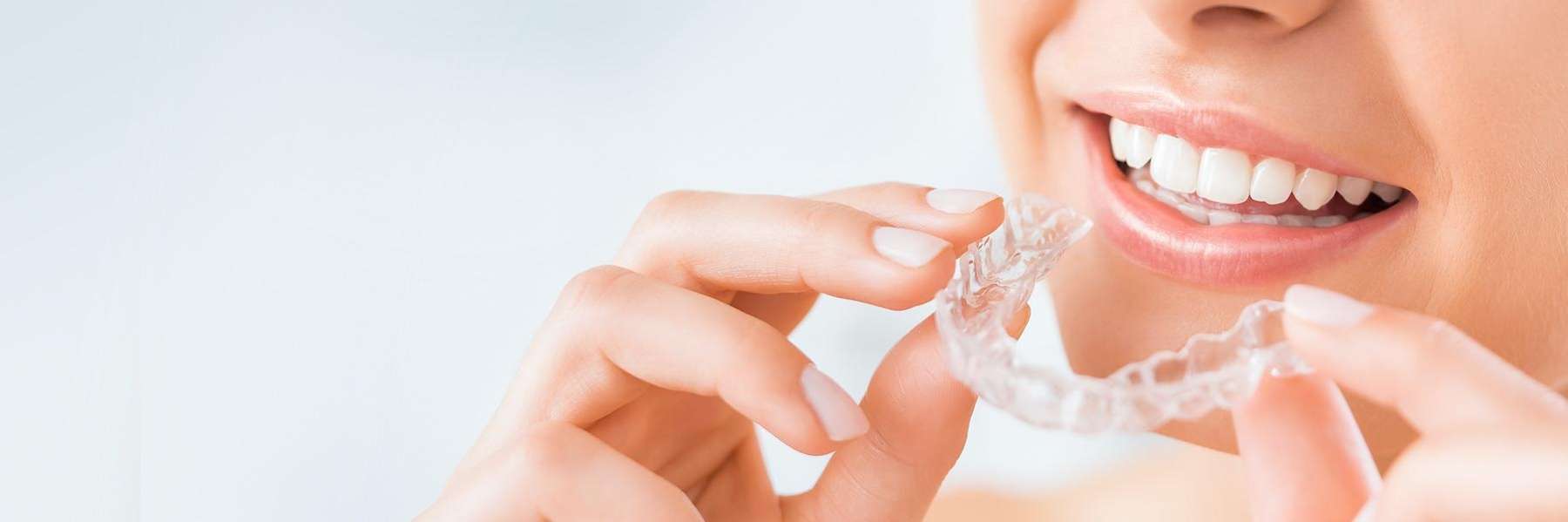 Clear Aligner Therapy | Dentist